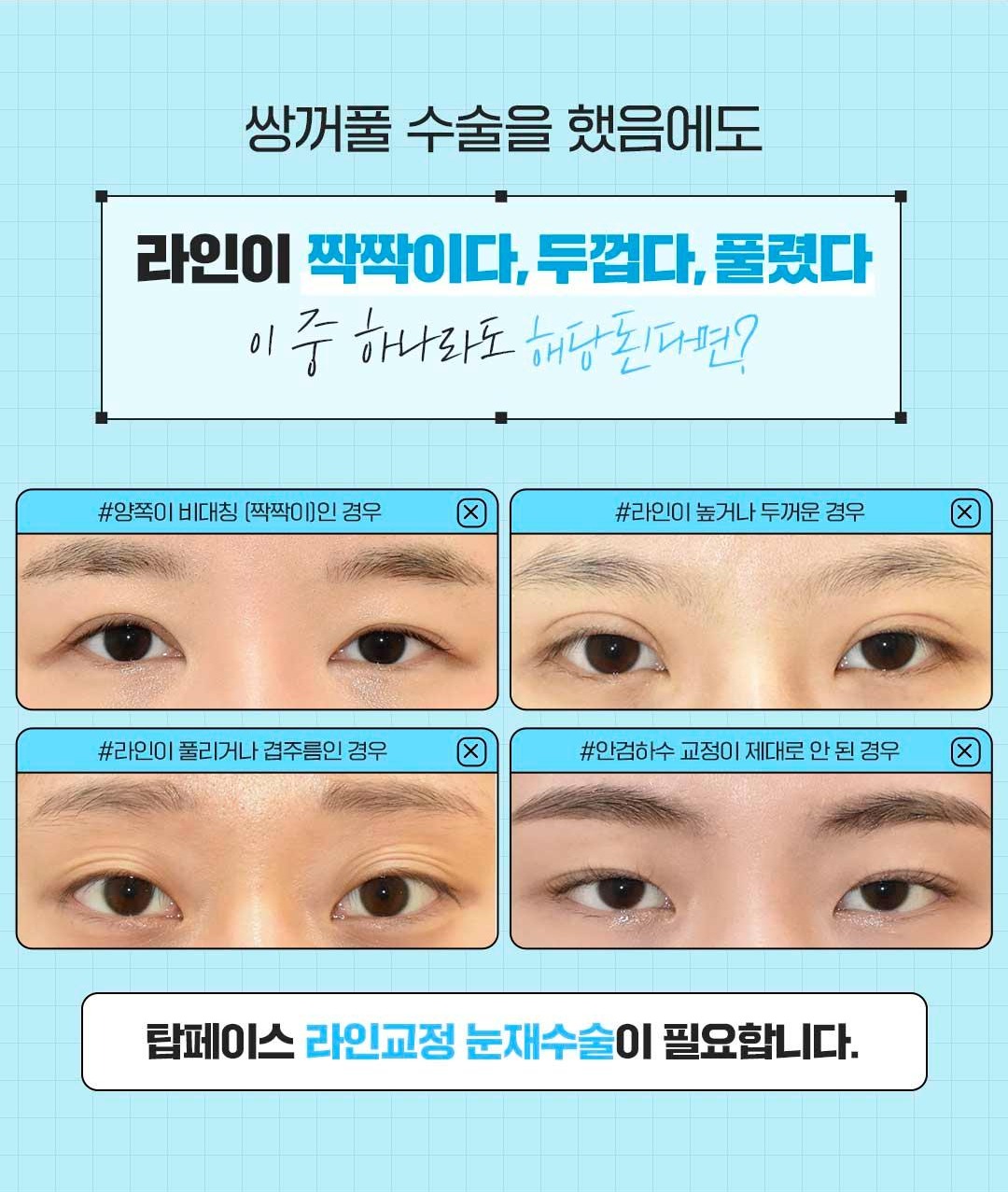 섹션 6