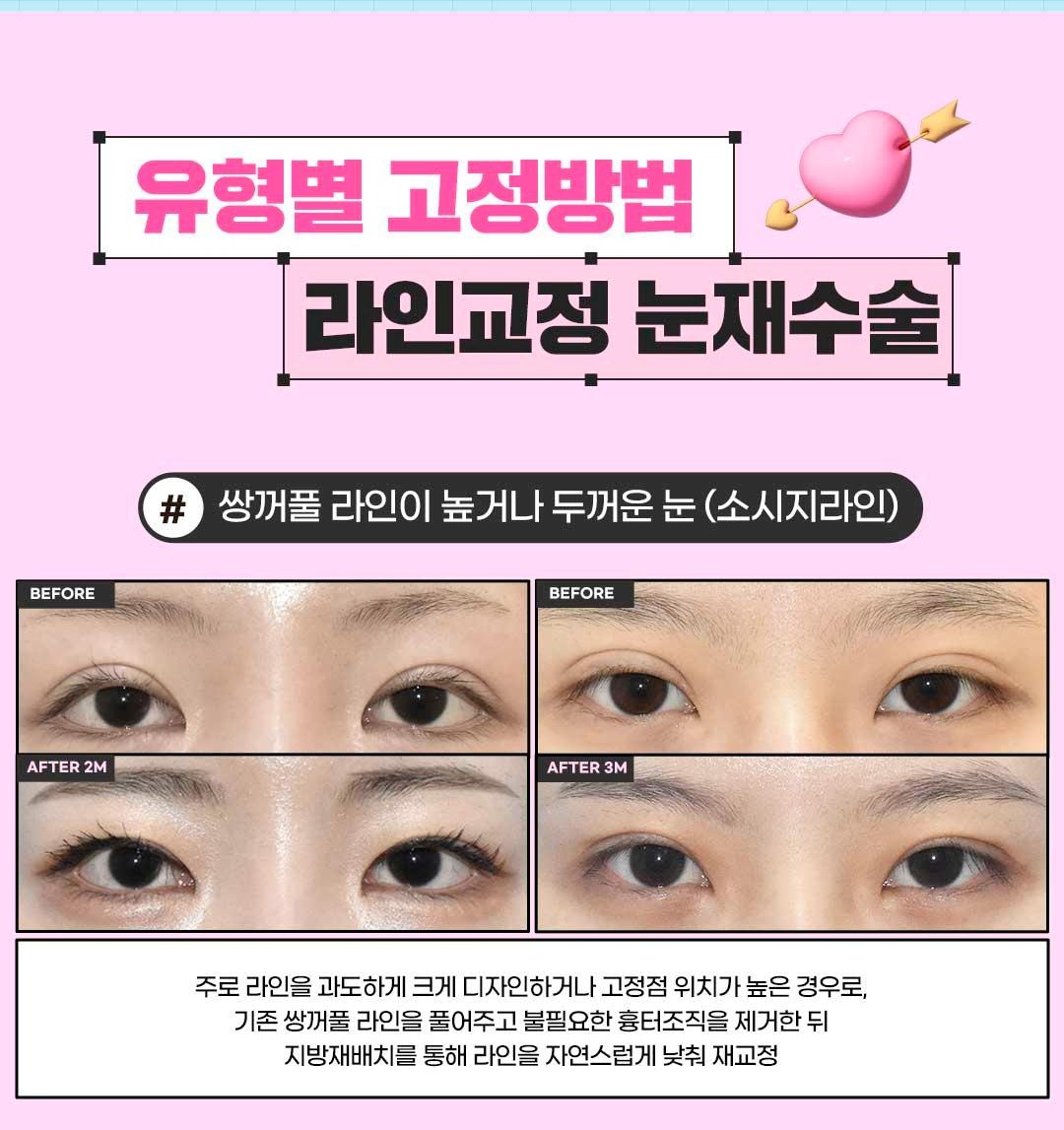 섹션 7