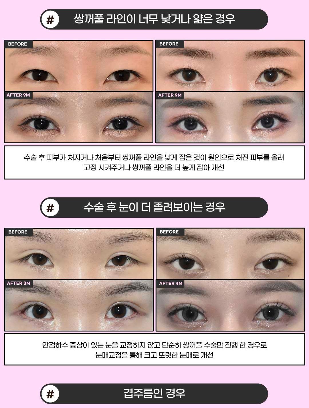 섹션 9